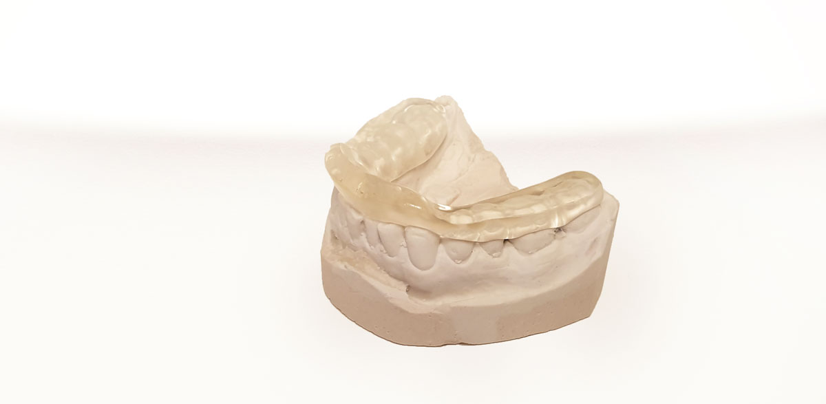 Teeth Grinding